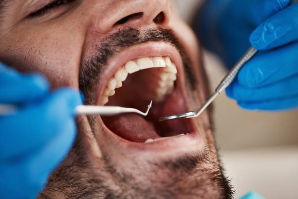 Best Emergency Dental Care for Broken or Chipped Teeth in Wausau, WI
